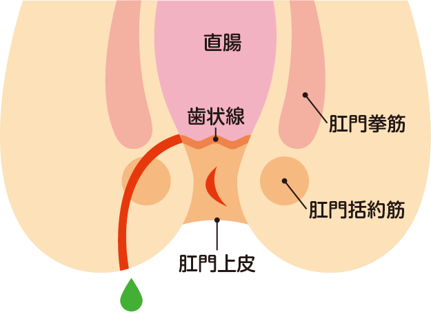 看護師は、勃起不全を治療するためにシルデナフィルについてクライアントに教えています